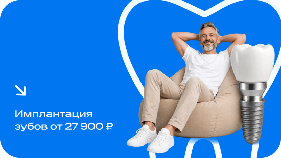 Имплантация зубов от 27900₽