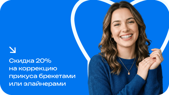 Скидка 20% на коррекцию прикуса брекетами или элайнерами