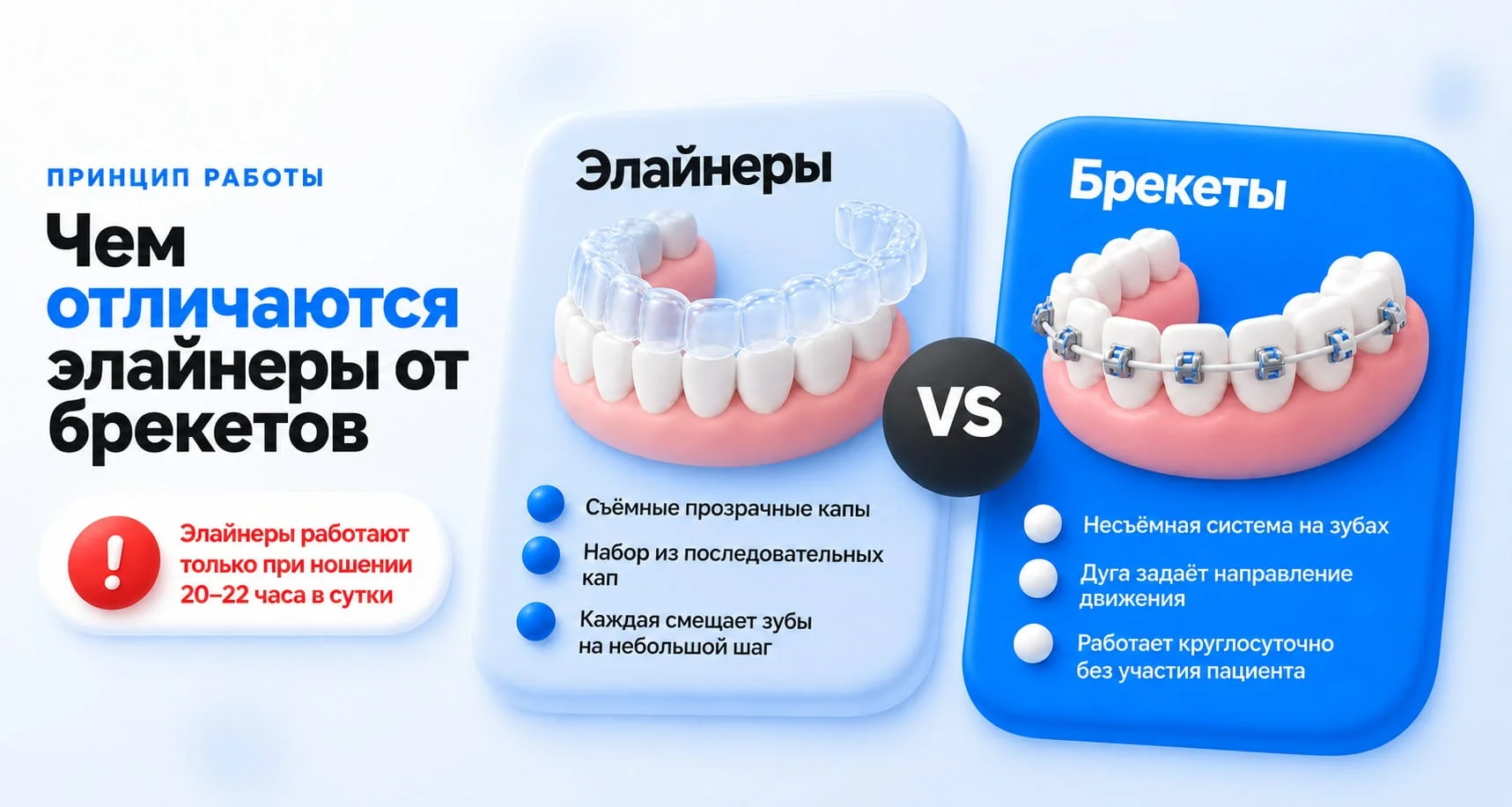 Чем отличаются элайнеры от брекетов: съёмные прозрачные капы и несъёмная брекет-система с дугой