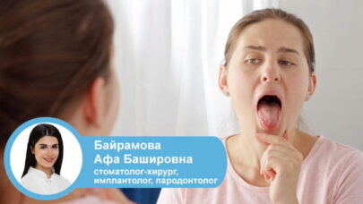 Жжение языка: 5 главных причин и когда пора к врачу