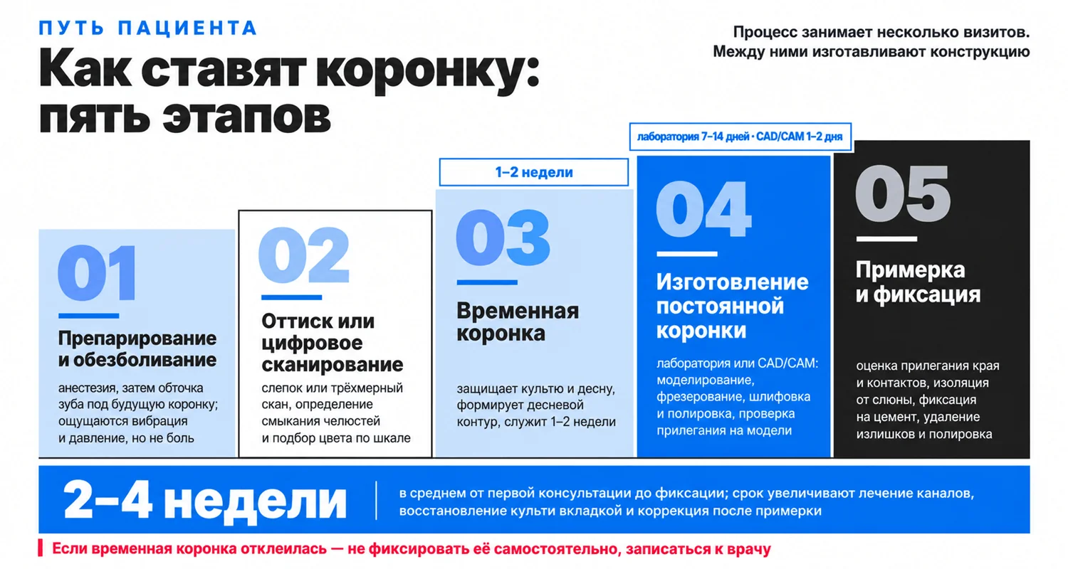 Этапы установки коронки на зуб: препарирование, оттиск или сканирование, временная коронка, изготовление в лаборатории, примерка и фиксация