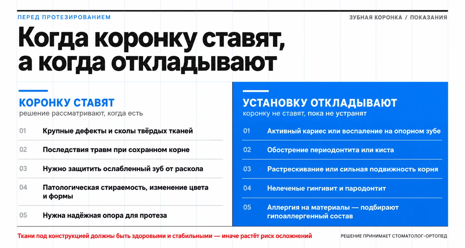 Когда ставят коронку на зуб и когда установку откладывают: показания при разрушении зуба и противопоказания при кариесе, воспалении, подвижности корня и болезнях пародонта