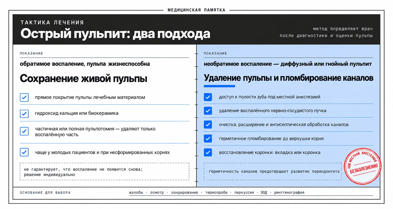 Лечение острого пульпита: биологический метод с сохранением живой пульпы и эндодонтическое лечение с удалением пульпы и пломбированием каналов