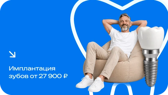 Имплантация зубов от 27900₽